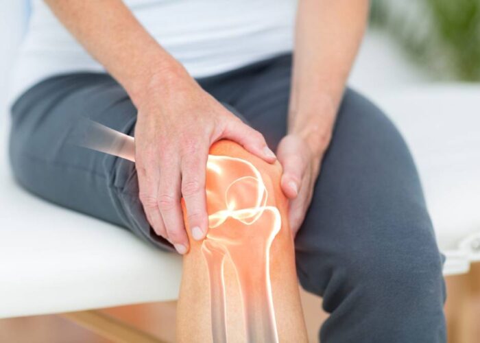 Physiotherapy for Arthritis